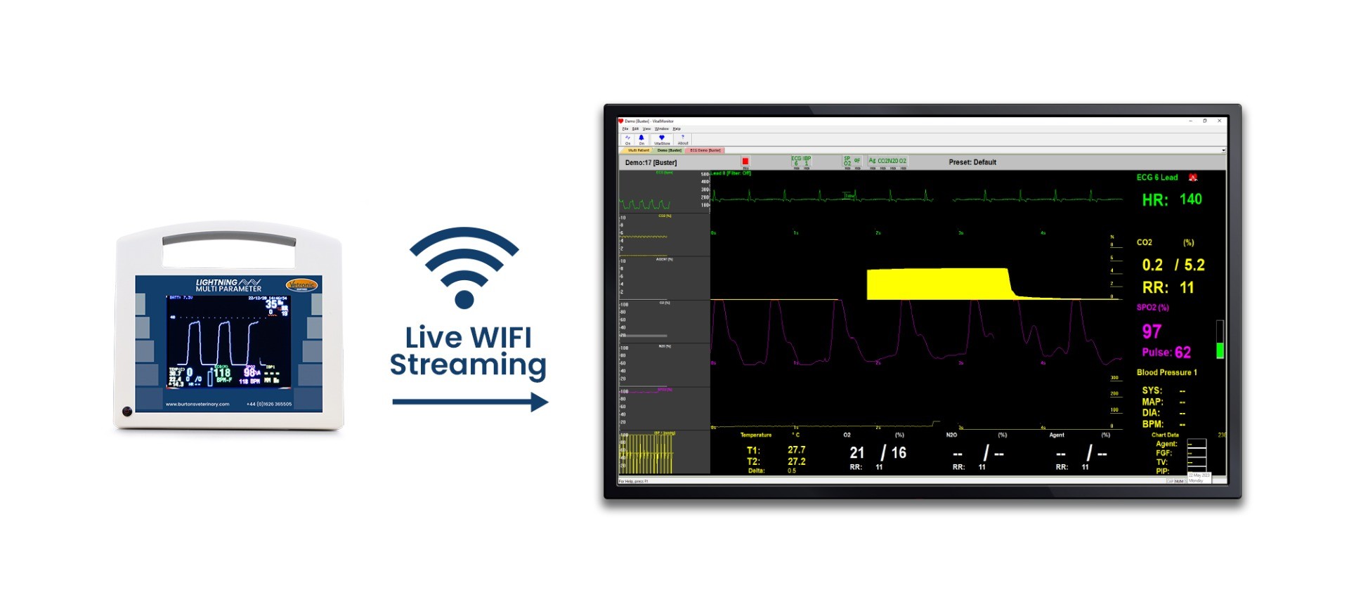 lightning monitor with wifi connected screen