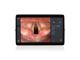 HugeMed MS-8 Semi-Disposable Small Animal Bronchoscopy Solution
