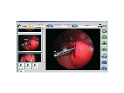ICAP V6.0 Image Capture System (Software Only) 